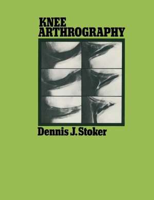 Knee Arthrography de Dennis J. Stoker