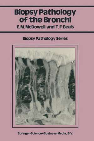 Biopsy Pathology of the Bronchi de Elizabeth M. McDowell