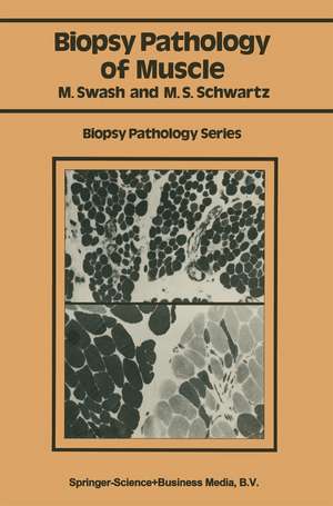 Biopsy pathology of muscle de Michael Swash