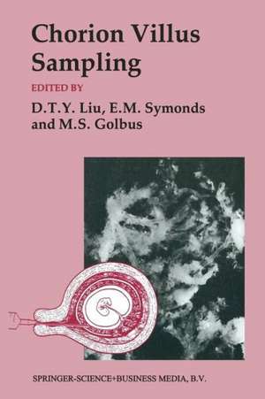 Chorion Villus Sampling de Mitchell S. Golbus