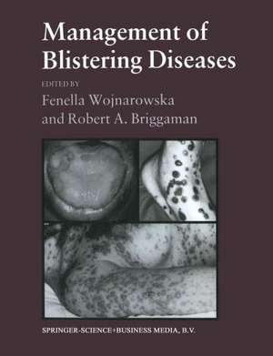 Management of Blistering Diseases de Robert A. Briggaman Fenella Wojnarowska