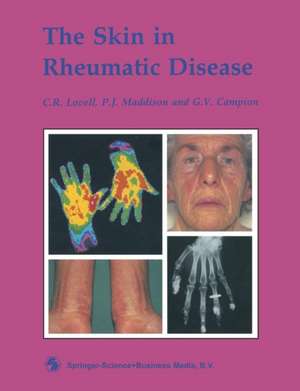 The Skin in Rheumatic Disease de C. R. Lovell