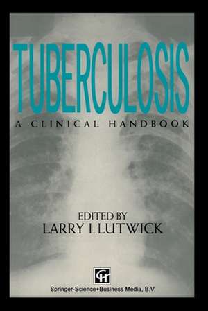 Tuberculosis de Larry Lutwick