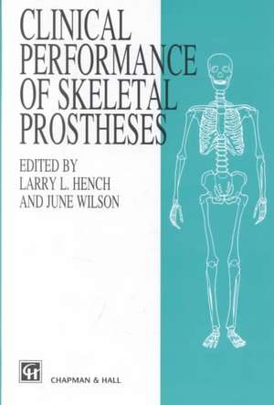 Clinical Perfomance of Skeletal Prostheses de Hench