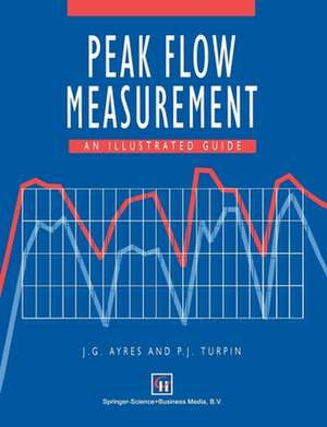 Peak Flow Measurement: An illustrated guide de J. G. Ayres