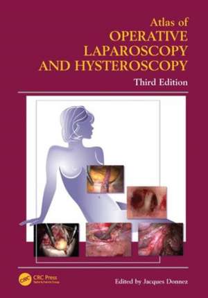 Atlas of Operative Laparoscopy and Hysteroscopy de Jacques Donnez