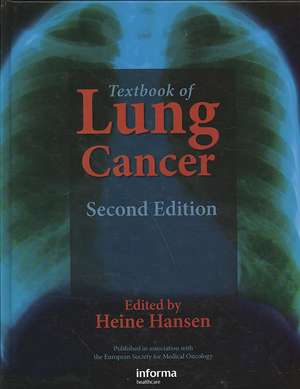 Textbook of Lung Cancer de Heine Hansen