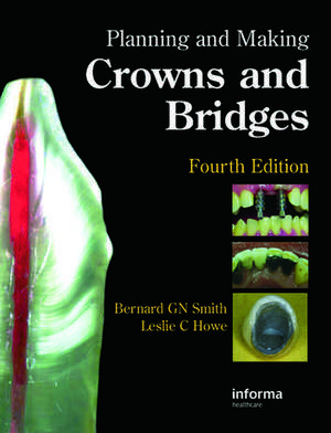 Planning and Making Crowns and Bridges de Bernard G. N. Smith