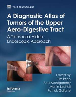 A Diagnostic Atlas of Tumors of the Upper Aero-Digestive Tract: A Transnasal Video Endoscopic Approach de Tim Price