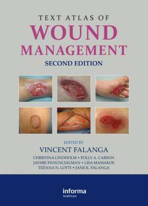 Text Atlas of Wound Management de Vincent Falanga