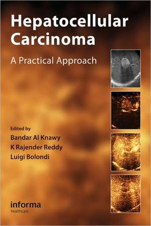 Hepatocellular Carcinoma: A Practical Approach de Bandar Al Knawy