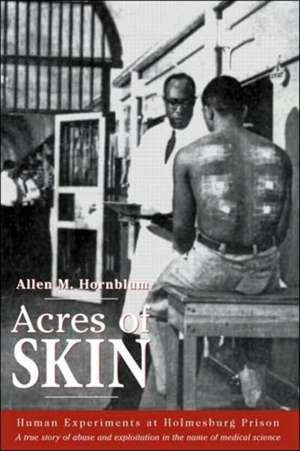 Acres of Skin: Human Experiments at Holmesburg Prison de Allen M. Hornblum