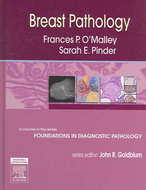 Breast Pathology: A Volume in Foundations in Diagnostic Pathology Series de Frances P. O'Malley