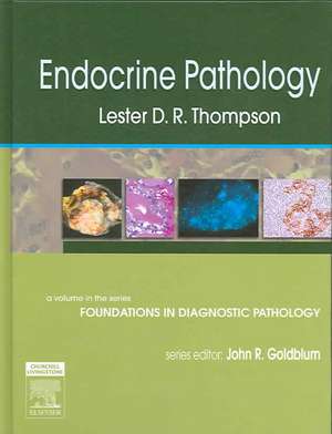 Endocrine Pathology: A Volume in Foundations in Diagnostic Pathology Series de Lester D. R. Thompson