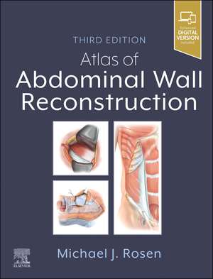 Atlas of Abdominal Wall Reconstruction de Michael J. Rosen