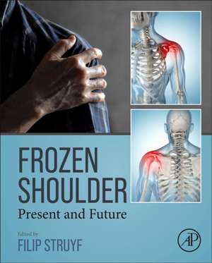 Frozen Shoulder: Present and Future de Filip Struyf