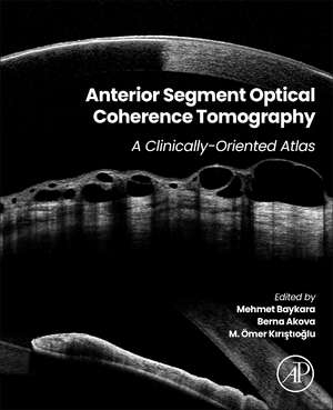 Anterior Segment Optical Coherence Tomography: A Clinically-Oriented Atlas de Mehmet Baykara