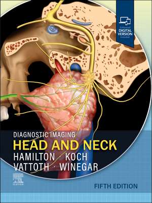 Diagnostic Imaging: Head and Neck de Bronwyn E. Hamilton