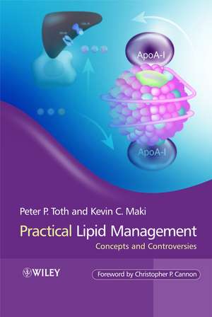 Practical Lipid Management de Peter P Toth