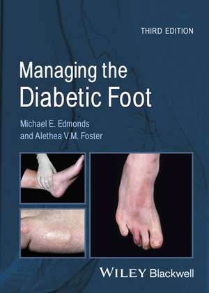 Managing the Diabetic Foot 3e de M Edmonds