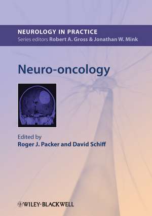 Neuro–oncology de RJ Packer