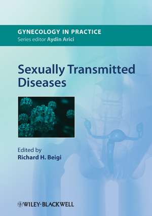 Sexually Transmitted Diseases de R Beigi