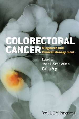 Colorectal Cancer – Diagnosis and Clinical Management de J Scholefield