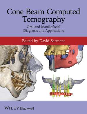 Cone Beam Computed Tomography – Oral and Maxillofacial Diagnosis and Applications de D Sarment