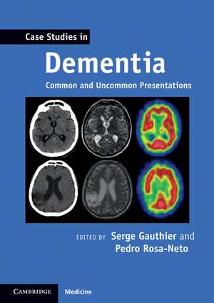 Case Studies in Dementia: Volume 1: Common and Uncommon Presentations de Serge Gauthier