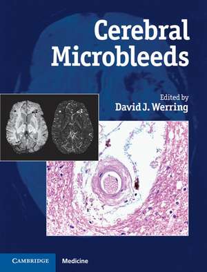 Cerebral Microbleeds: Pathophysiology to Clinical Practice de David J. Werring