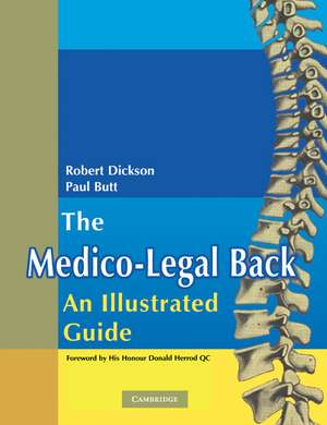 The Medico-Legal Back: An Illustrated Guide de Robert A. Dickson