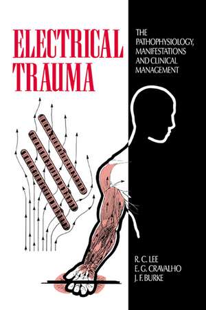 Electrical Trauma: The Pathophysiology, Manifestations and Clinical Management de R. C. Lee