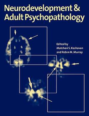 Neurodevelopment and Adult Psychopathology de Matcheri S. Keshavan