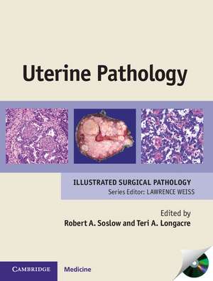 Uterine Pathology de Robert A. Soslow MD