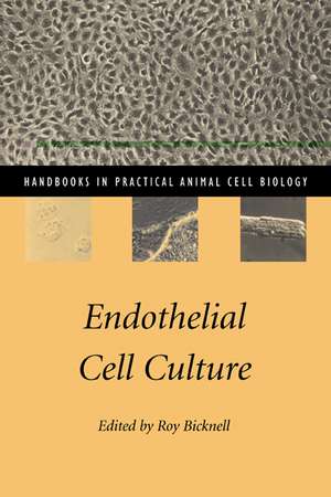 Endothelial Cell Culture de Roy Bicknell