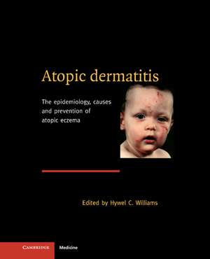 Atopic Dermatitis: The Epidemiology, Causes and Prevention of Atopic Eczema de Hywel C. Williams