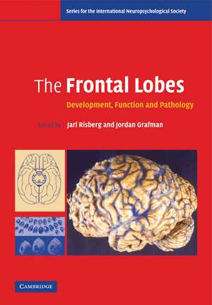 The Frontal Lobes: Development, Function and Pathology de Jarl Risberg