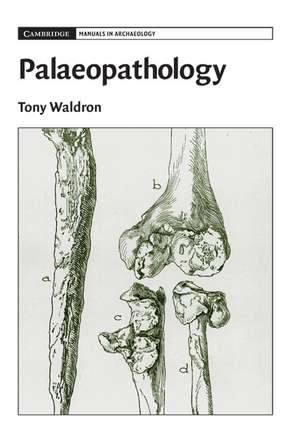 Palaeopathology de Tony Waldron