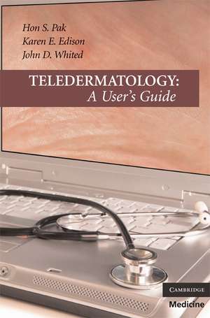 Teledermatology: A User's Guide de Hon S. Pak MD