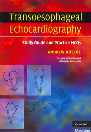 Transoesophageal Echocardiography: Study Guide and Practice MCQs de Andrew Roscoe