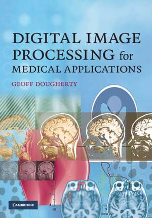 Digital Image Processing for Medical Applications Applications