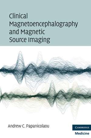 Clinical Magnetoencephalography and Magnetic Source Imaging de Andrew C. Papanicolaou