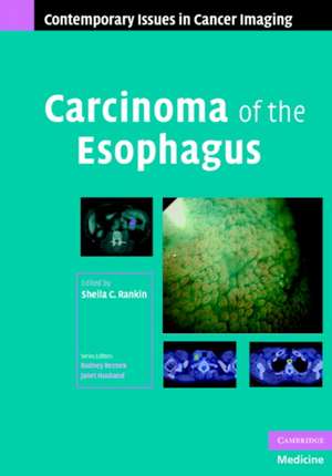 Carcinoma of the Esophagus alte