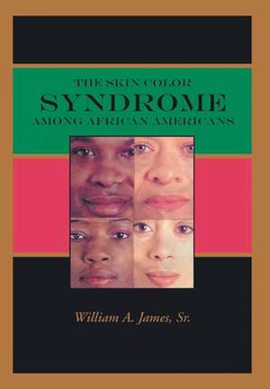 The Skin Color Syndrome Among African-Americans de Sr. William a. James