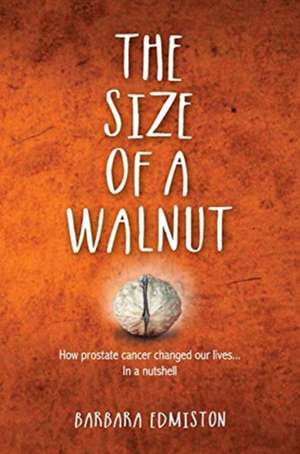 THE SIZE OF A WALNUT de Barbara Edmiston