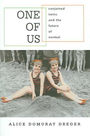 One of Us – Conjoined Twins and the Future of Normal de Alice Domurat Dreger