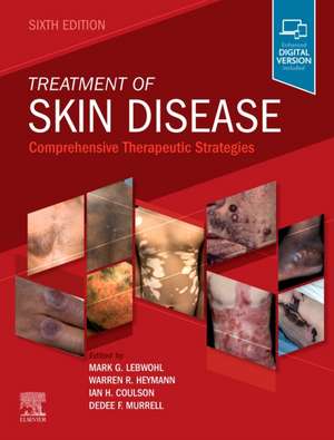 Treatment of Skin Disease: Comprehensive Therapeutic Strategies de Mark Lebwohl