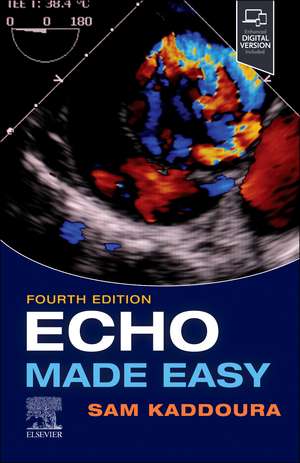 Echo Made Easy de Sam Kaddoura