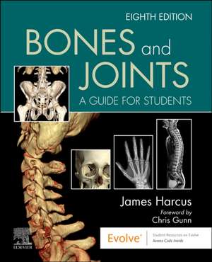 Bones and Joints: A Guide for Students de James Harcus