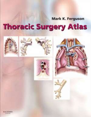 Thoracic Surgery Atlas de Mark K. Ferguson